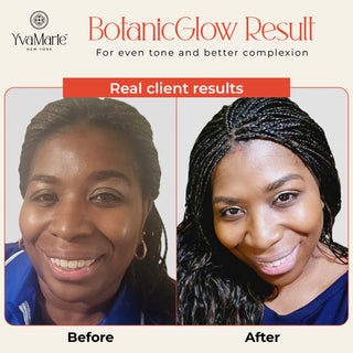 Before and after comparison of a client's skin with BotanicGlow Result, featuring Yvamarie New York.